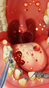 疯狂的诊所中文版